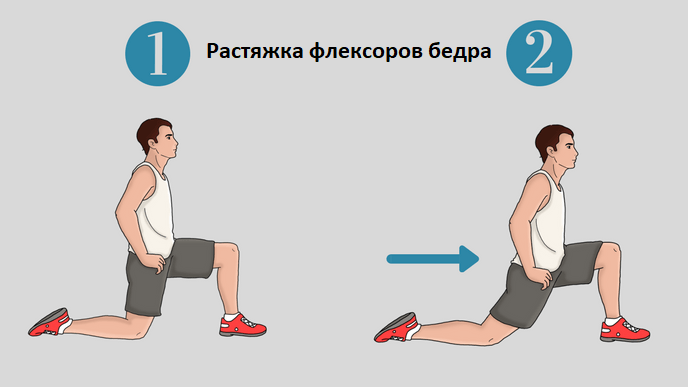 виды растяжек и их роль в физической терапии