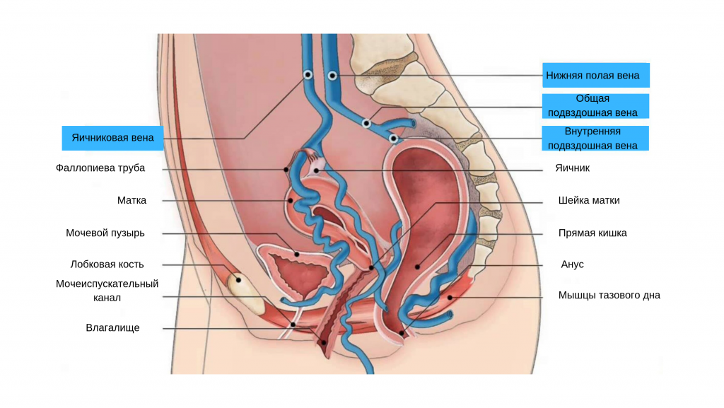 синдром тазового венозного полнокровия