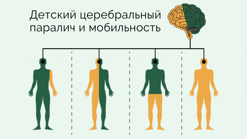 детский церебральный паралич и мобильность