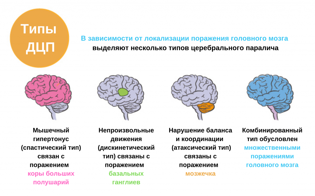 детский церебральный паралич и мобильность