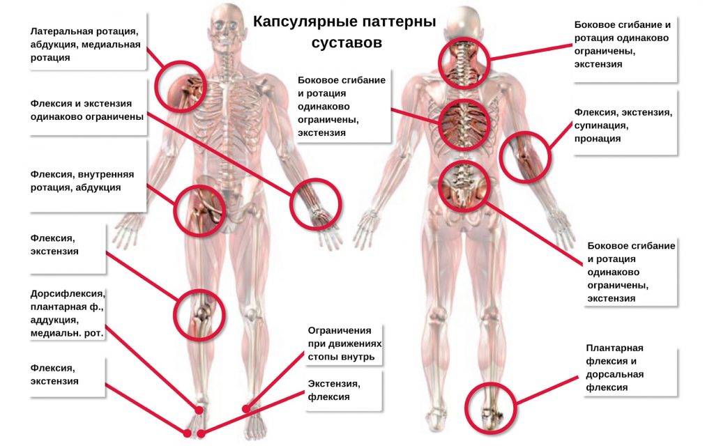 капсулярный и некапсулярный паттерны