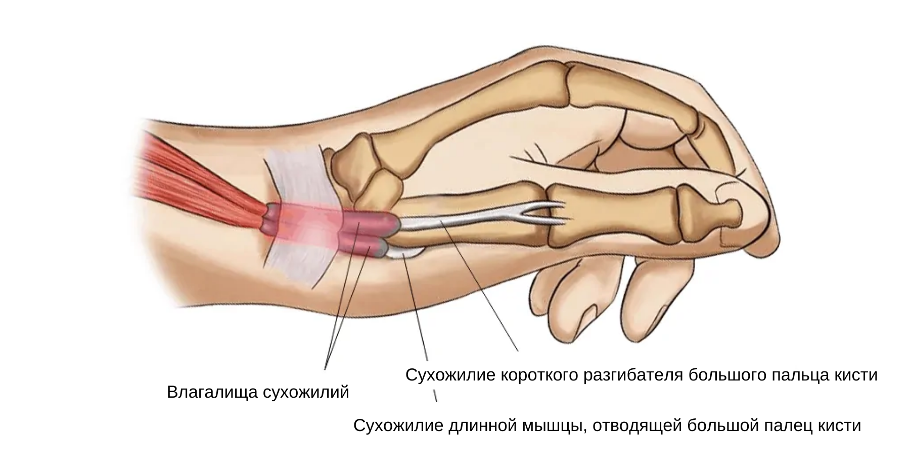 Теносиновит де Кервена