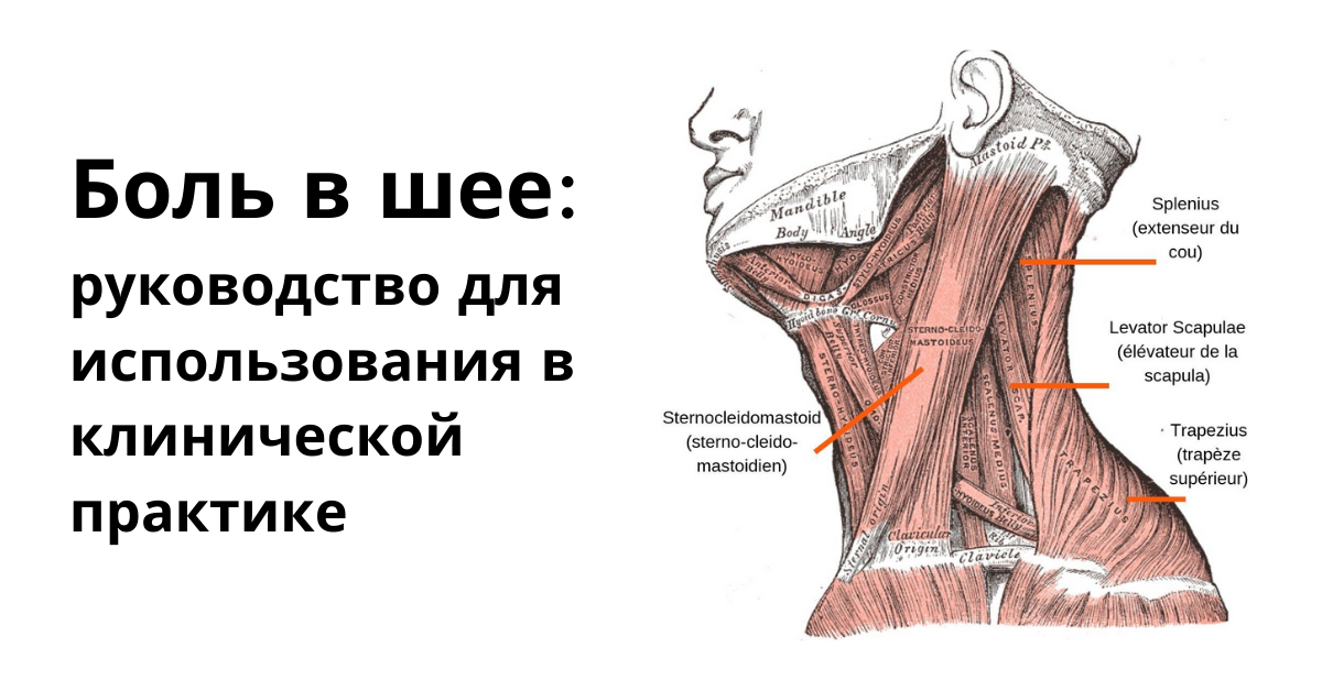 Боль в шее: руководство для использования в клинической практике