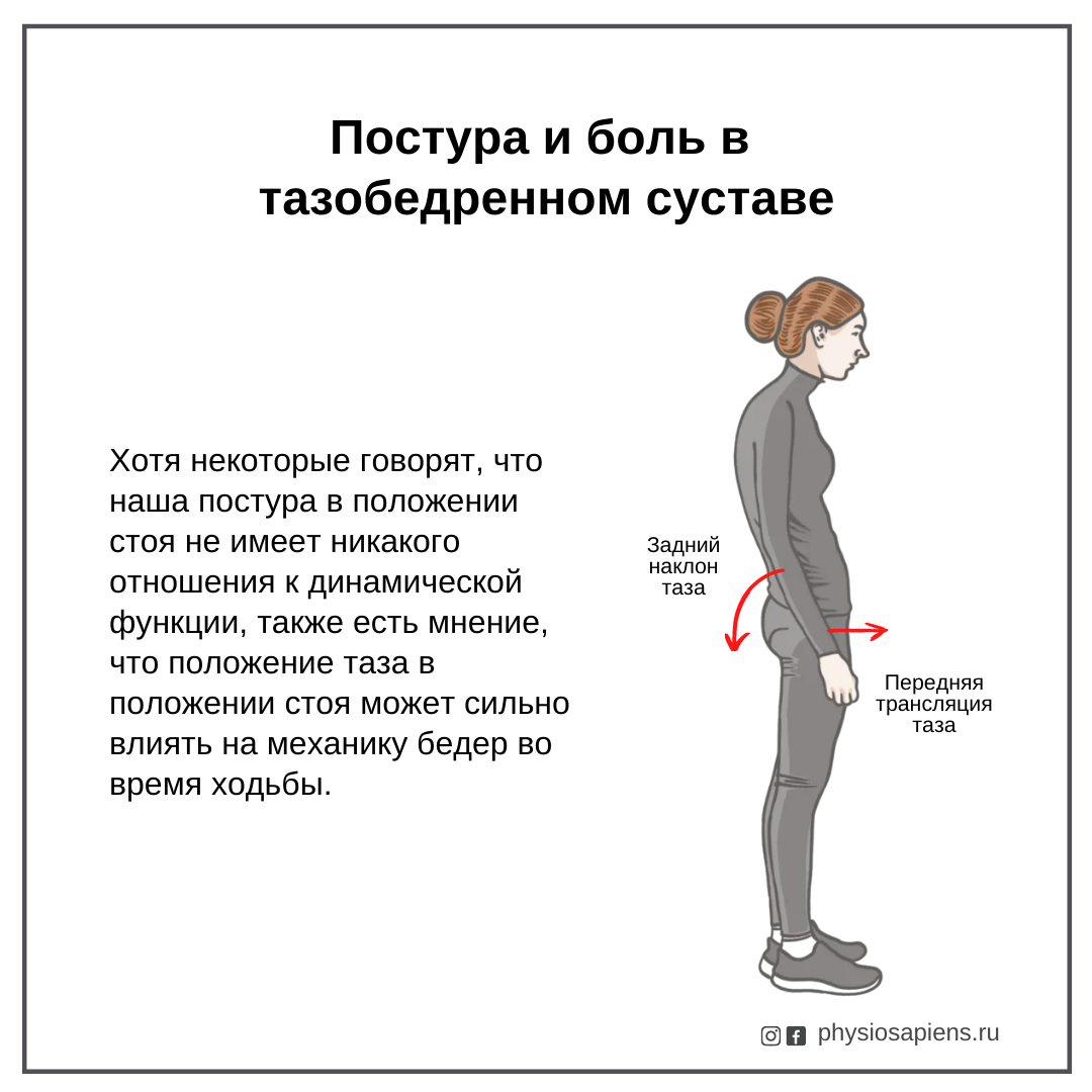 Постура и боль в тазобедренном суставе