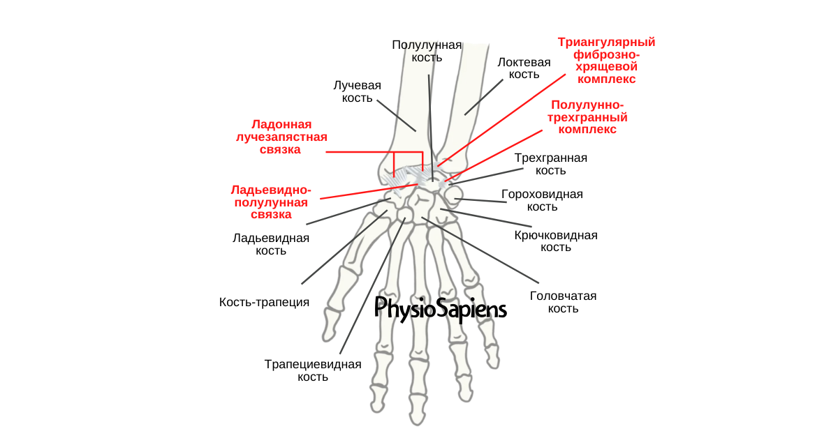 Растяжение запястья