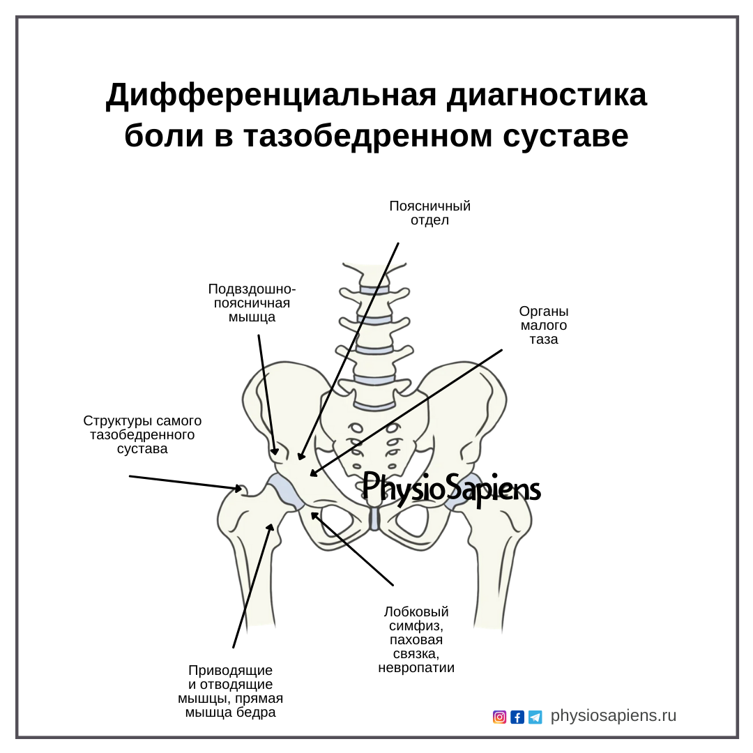 Дифференциальная диагностика боли в тазобедренном суставе