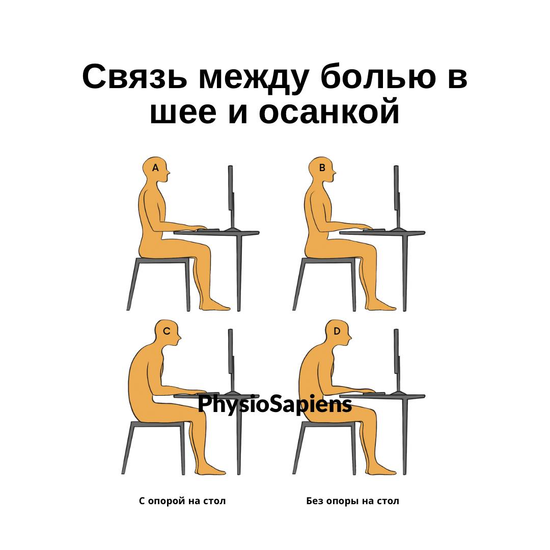 Связь между болью в шее и осанкой