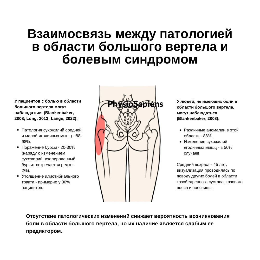 Боль в боковой части бедра: причины, диагностика и лечение