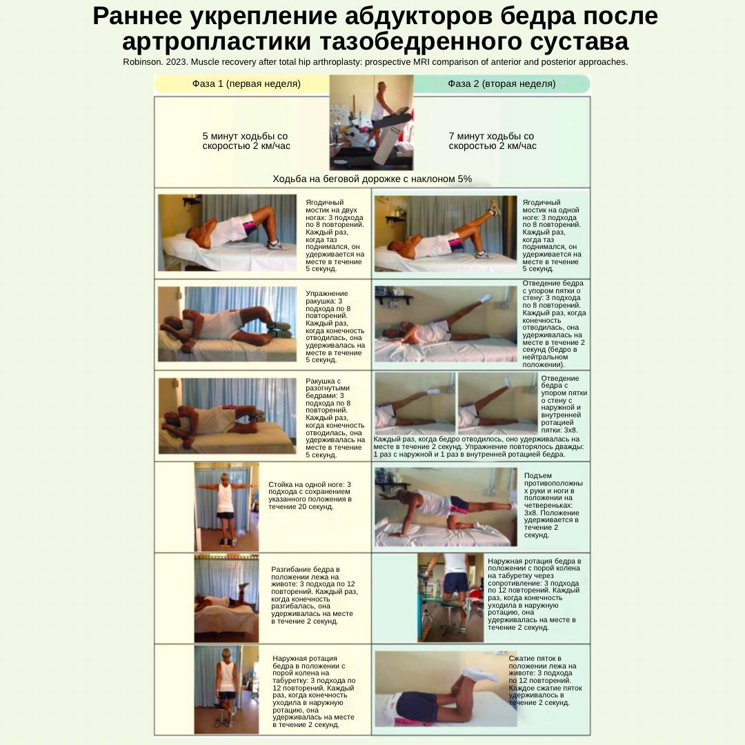 Раннее укрепление абдукторов бедра после тотальной артропластики тазобедренного сустава